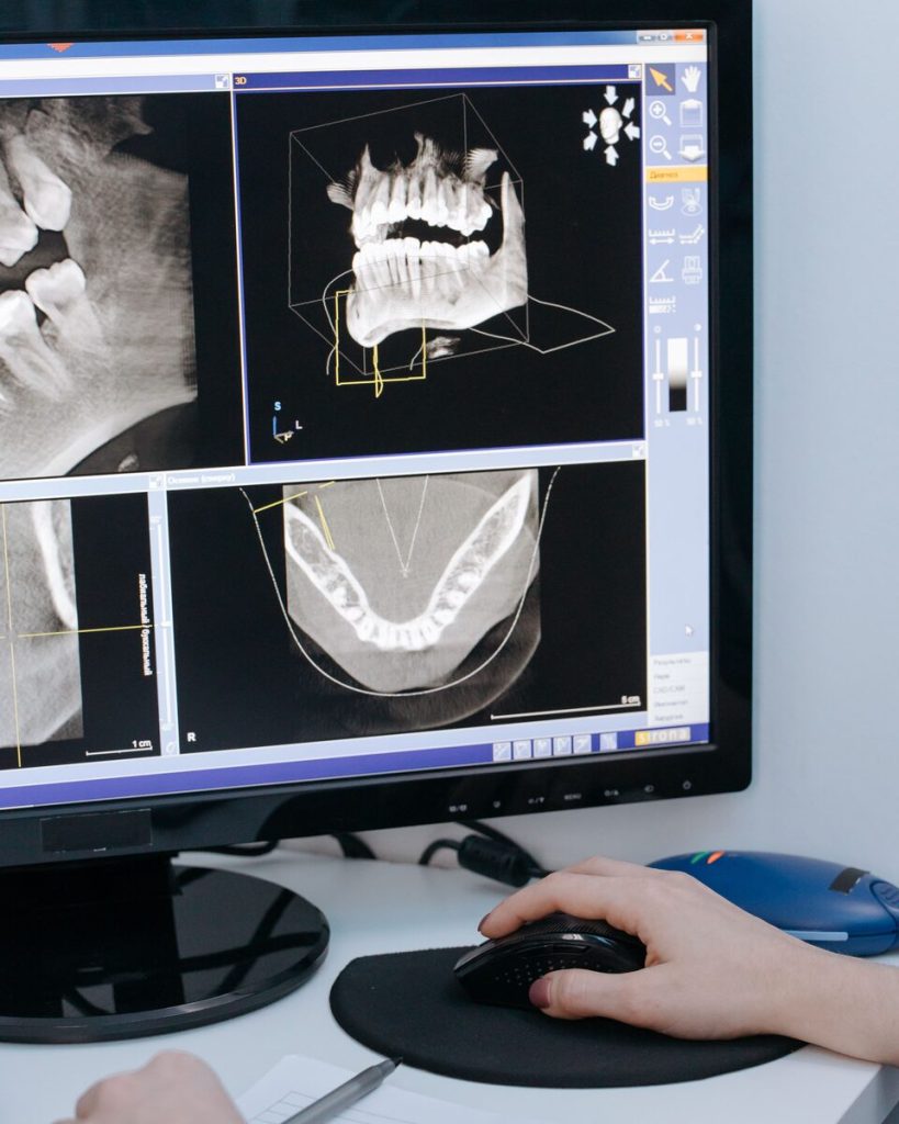 A 3D scan of the jaw on a monitor, shown as a rotatable model and as cross-section slices