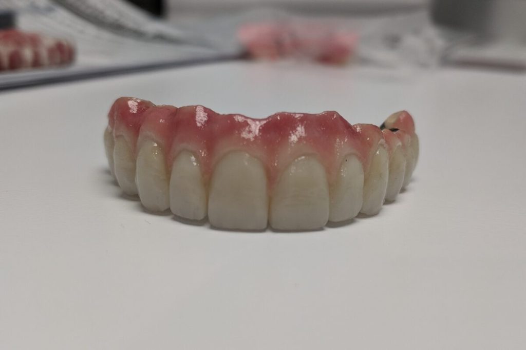 A full-arch upper denture resting on a white counter