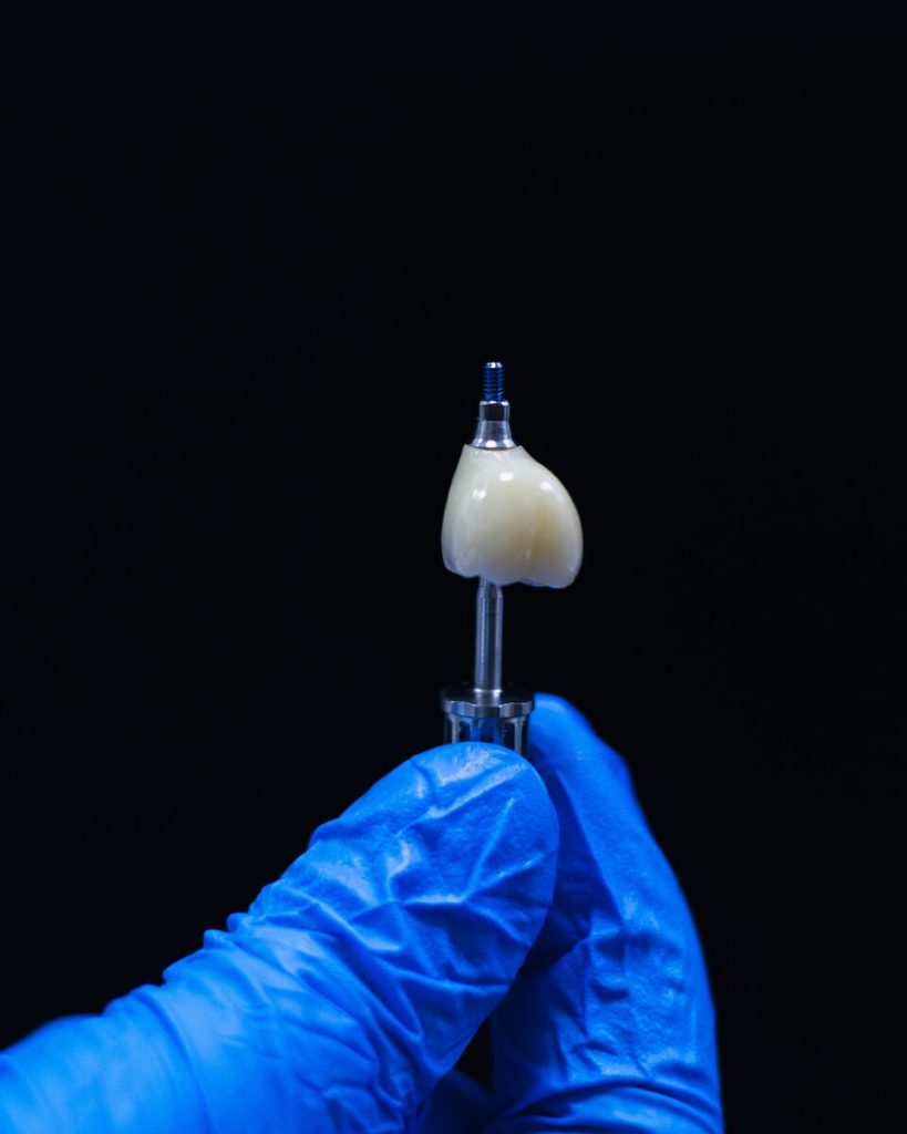 A gloved hand holds a single implant crown on its abutment against a black background