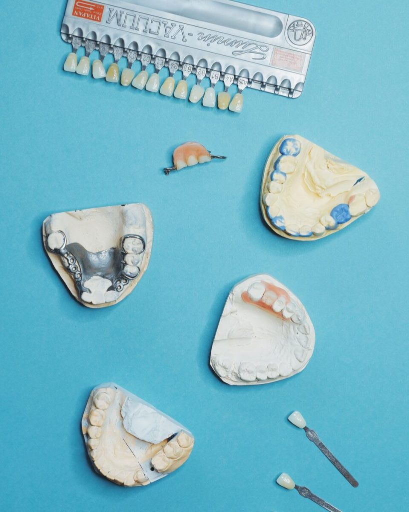 Several partial dentures on plaster models, laid out beside a tooth shade guide