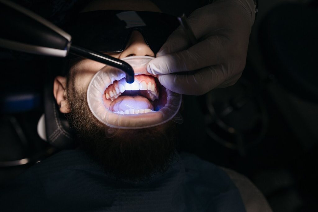 A blue curing light sets a tooth-colored filling while the patient's lips are held back by a retractor