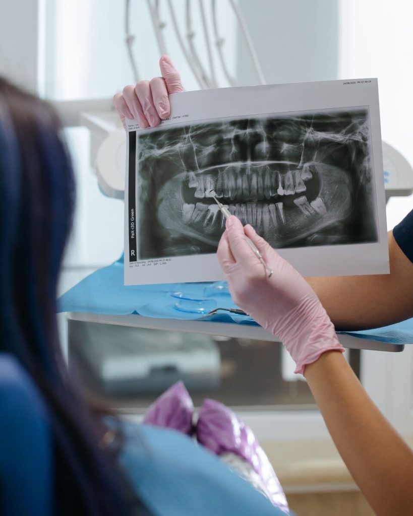 A gloved hand points to a tooth on a panoramic x-ray held up beside a patient in the chair